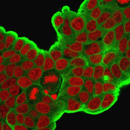 Anti-HSP27 antibody [HSPB1/774] used in Immunocytochemistry/ Immunofluorescence (ICC/IF). GTX34783