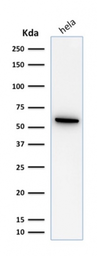 Anti-HSP60 antibody [SPM253] used in Western Blot (WB). GTX34786