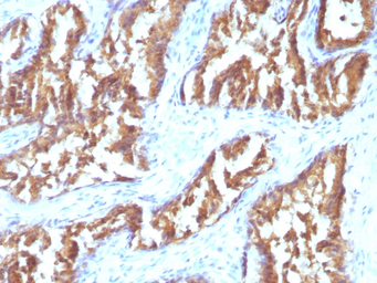 Anti-IDH1 antibody [IDH1/1152] used in IHC (Paraffin sections) (IHC-P). GTX34793