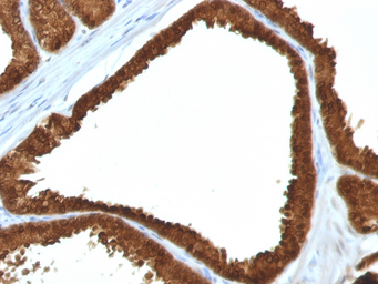 Anti-IDH1 antibody [IDH1/1152] used in IHC (Paraffin sections) (IHC-P). GTX34793