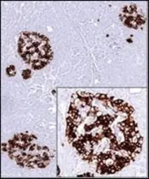 Anti-Insulin antibody [SPM531] used in IHC (Paraffin sections) (IHC-P). GTX34797