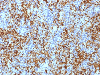 Anti-Integrin beta 3 antibody [ITGB3/1713] used in IHC (Paraffin sections) (IHC-P). GTX34800