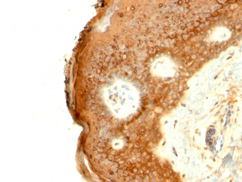 Anti-Involucrin antibody [SPM259] used in IHC (Paraffin sections) (IHC-P). GTX34802
