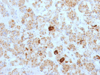 Anti-LH beta antibody [SPM103] used in IHC (Paraffin sections) (IHC-P). GTX34808