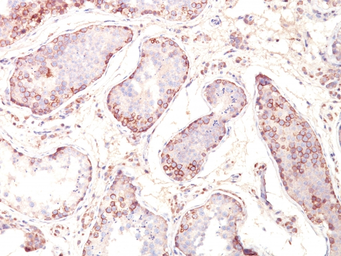 Anti-MAGE 1 antibody [MZ2E/838] used in IHC (Paraffin sections) (IHC-P). GTX34811