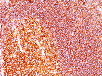 Anti-MALT1 antibody [MT1/410] used in IHC (Paraffin sections) (IHC-P). GTX34812