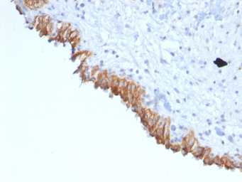 Anti-MAML2 antibody [MAML2/1302] used in IHC (Paraffin sections) (IHC-P). GTX34814
