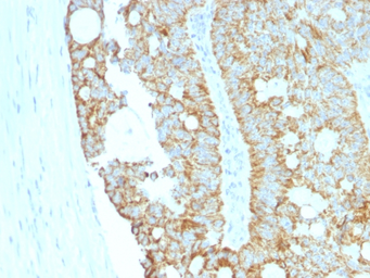 Anti-MAML2 antibody [MAML2/1302] used in IHC (Paraffin sections) (IHC-P). GTX34814