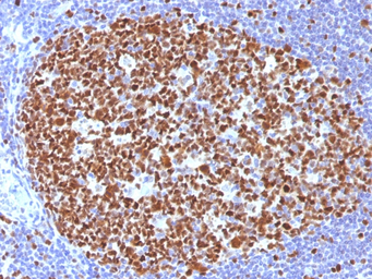 Anti-MCM7 antibody [MCM7/1466] used in IHC (Paraffin sections) (IHC-P). GTX34817