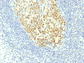 Anti-MCM7 antibody [MCM7/1467] used in IHC (Paraffin sections) (IHC-P). GTX34818