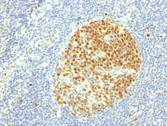 Anti-MCM7 antibody [MCM7/1469] used in IHC (Paraffin sections) (IHC-P). GTX34820