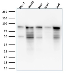 Anti-MCM7 antibody [MCM7/1469] used in Western Blot (WB). GTX34820