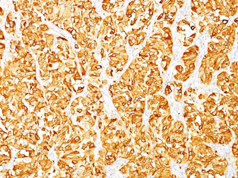 Anti-Melan A antibody [M2-7C10] used in IHC (Paraffin sections) (IHC-P). GTX34823