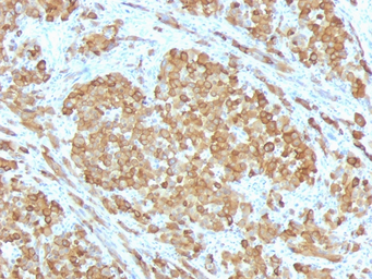 Anti-Melan A antibody [SPM555] used in IHC (Paraffin sections) (IHC-P). GTX34828