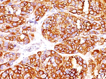Anti-Melan A antibody [MLANA/1409R] used in IHC (Paraffin sections) (IHC-P). GTX34831