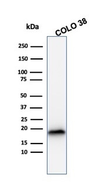 Anti-Melan A antibody [MLANA/1409R] used in Western Blot (WB). GTX34831