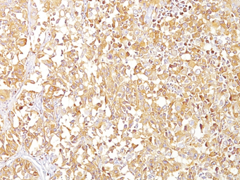 Anti-Melanoma gp100 antibody [SPM142] used in IHC (Paraffin sections) (IHC-P). GTX34834