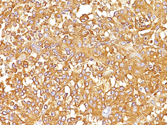 Anti-Melanoma gp100 antibody [SPM142] used in IHC (Paraffin sections) (IHC-P). GTX34834