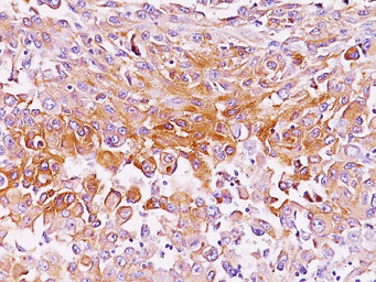 Anti-Melanoma gp100 antibody [SPM286] used in IHC (Paraffin sections) (IHC-P). GTX34836