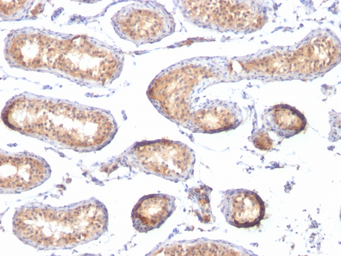 Anti-Melanoma gp100 antibody [PMEL/783] used in IHC (Paraffin sections) (IHC-P). GTX34837