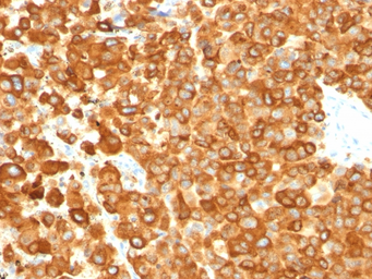 Anti-Melanoma gp100 antibody [PMEL/783] used in IHC (Paraffin sections) (IHC-P). GTX34837