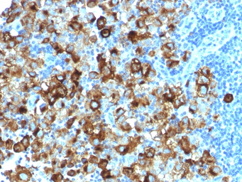 Anti-Melanoma gp100 antibody [PMEL/1825R] used in IHC (Paraffin sections) (IHC-P). GTX34838