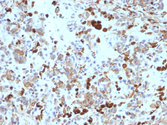 Anti-MITF antibody [MITF/915] used in IHC (Paraffin sections) (IHC-P). GTX34844