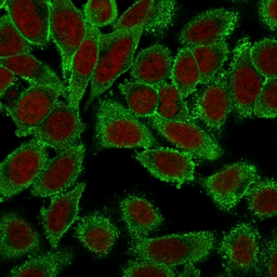 Anti-Moesin antibody [MSN/491] used in Immunocytochemistry/ Immunofluorescence (ICC/IF). GTX34846