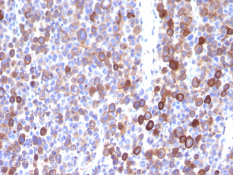 Anti-Moesin antibody [MSN/491] used in IHC (Paraffin sections) (IHC-P). GTX34846