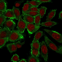 Anti-Moesin antibody [MSN/492] used in Immunocytochemistry/ Immunofluorescence (ICC/IF). GTX34848