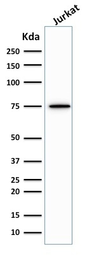Anti-Moesin antibody [MSN/492] used in Western Blot (WB). GTX34848