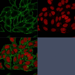 Anti-Moesin antibody [MSN/493] used in Immunocytochemistry/ Immunofluorescence (ICC/IF). GTX34849