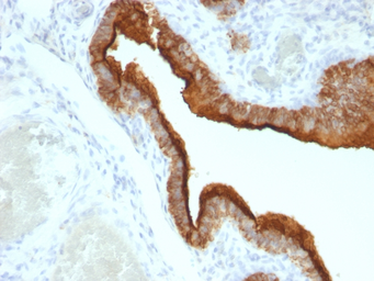 Anti-MUC1 antibody [HMPV] used in IHC (Paraffin sections) (IHC-P). GTX34851