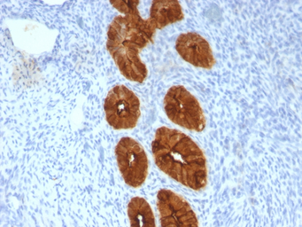 Anti-MUC1 antibody [MUC1/967] used in IHC (Paraffin sections) (IHC-P). GTX34854