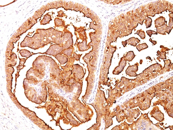 Anti-MUC1 antibody [E29] used in IHC (Paraffin sections) (IHC-P). GTX34857