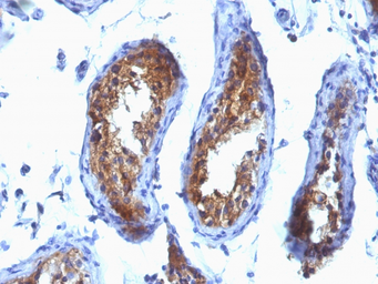 Anti-MVP/LRP antibody [SPM280] used in IHC (Paraffin sections) (IHC-P). GTX34877