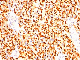 Anti-Myogenin antibody [SPM144] used in IHC (Paraffin sections) (IHC-P). GTX34886