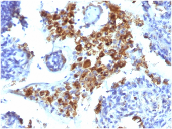 Anti-Napsin A antibody [NAPSA/1238] used in IHC (Paraffin sections) (IHC-P). GTX34887