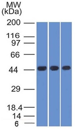 Anti-Napsin A antibody [NAPSA/1238] used in Western Blot (WB). GTX34887