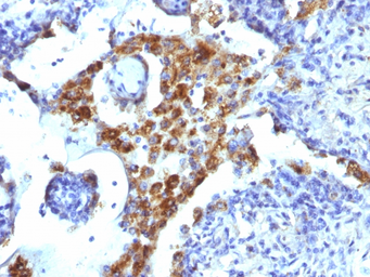 Anti-Napsin A antibody [NAPSA/1239] used in IHC (Paraffin sections) (IHC-P). GTX34888