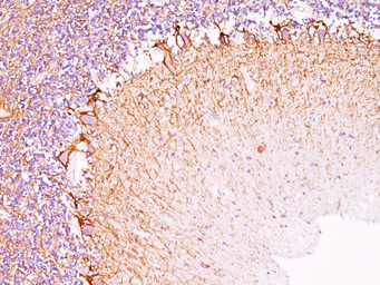 Anti-NF-L antibody [NR-4] used in IHC (Paraffin sections) (IHC-P). GTX34902