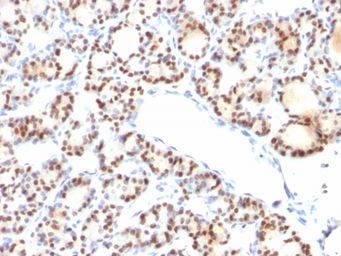 Anti-NKX2.1 antibody [NX2.1/690] used in IHC (Paraffin sections) (IHC-P). GTX34906