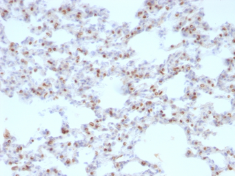 Anti-NKX2.1 antibody [NX2.1/690] used in IHC (Paraffin sections) (IHC-P). GTX34906