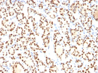 Anti-NKX2.1 antibody [8G7G3/1] used in IHC (Paraffin sections) (IHC-P). GTX34907