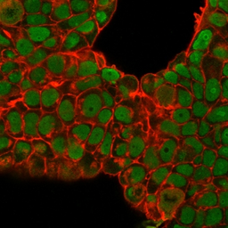Anti-Nucleolin antibody [SPM614] used in Immunocytochemistry/ Immunofluorescence (ICC/IF). GTX34915