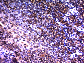Anti-NuMA antibody [A73-B/D12] used in IHC (Paraffin sections) (IHC-P). GTX34917