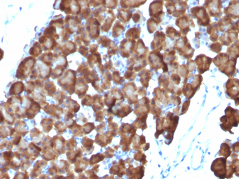 Anti-ODC antibody [ODC1/486] used in IHC (Paraffin sections) (IHC-P). GTX34921