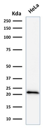 Anti-p21 Cip1 antibody [DCS-60.2] used in Western Blot (WB). GTX34927