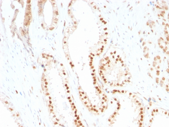 Anti-p27 Kip1 antibody [SX53G8] used in IHC (Paraffin sections) (IHC-P). GTX34928