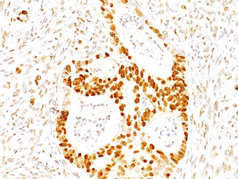 Anti-p27 Kip1 antibody [SX53G8] used in IHC (Paraffin sections) (IHC-P). GTX34928